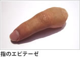 指のエピテーゼ